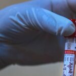 Representational image.