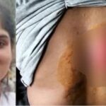 Student from Andhra Pradesh held for scalding her roommate