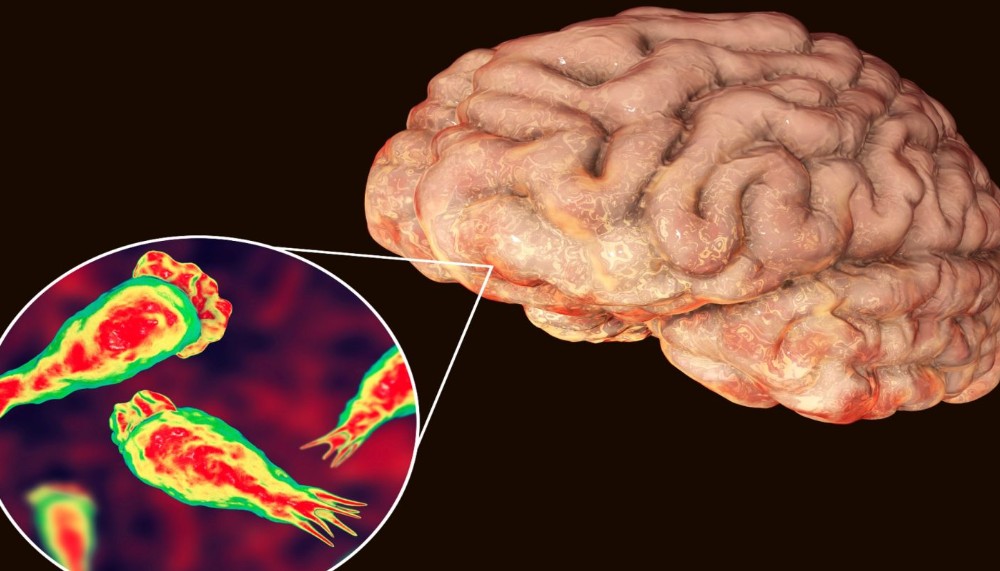 Brain-Eating Amoeba in Kerala: 2 More Deaths, Infant Among Victims